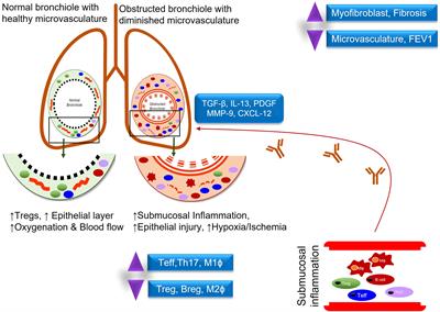 Monitoring regulatory T cells as a prognostic marker in lung transplantation